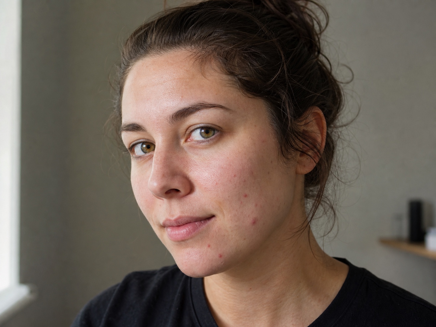 Portrait with temporary blemishes before cleanup